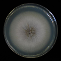 Figure 14: Colony of Some pathogenic fungi and Antifungal spectrum of some drugs