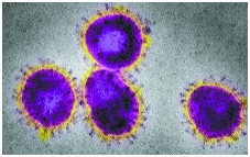 Figure 13: Common pathogenic viruses