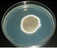 Figure 10: Colony of Some pathogenic fungi and Antifungal spectrum of some drugs