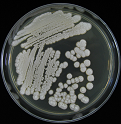 Figure 15: Colony of Some pathogenic fungi and Antifungal spectrum of some drugs