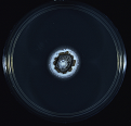 Figure 17: Colony of Some pathogenic fungi and Antifungal spectrum of some drugs