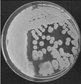 Figure 7: Colony of Some pathogenic fungi and Antifungal spectrum of some drugs