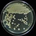Figure 9: Colony of Some pathogenic fungi and Antifungal spectrum of some drugs