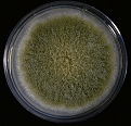 Figure 3: Colony of Some pathogenic fungi and Antifungal spectrum of some drugs