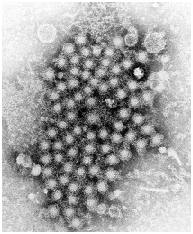 Figure 8: Common pathogenic viruses