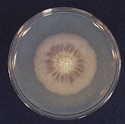 Figure 19: Colony of Some pathogenic fungi and Antifungal spectrum of some drugs